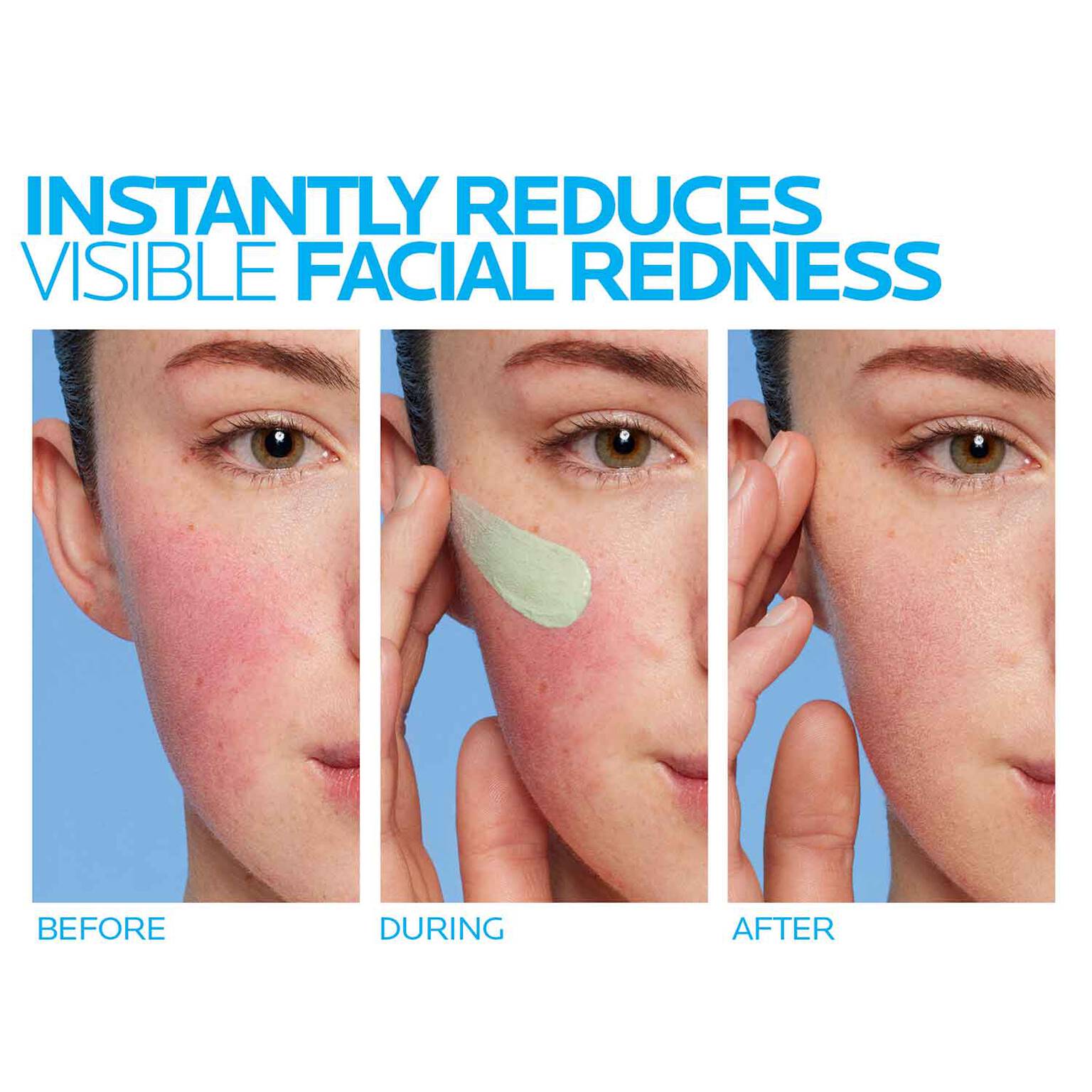 toleriane-rosaliac-ar-face-cream-for-visible-redness-h8 8_Toleriane_Rosaliac-AR-before-after.jpg