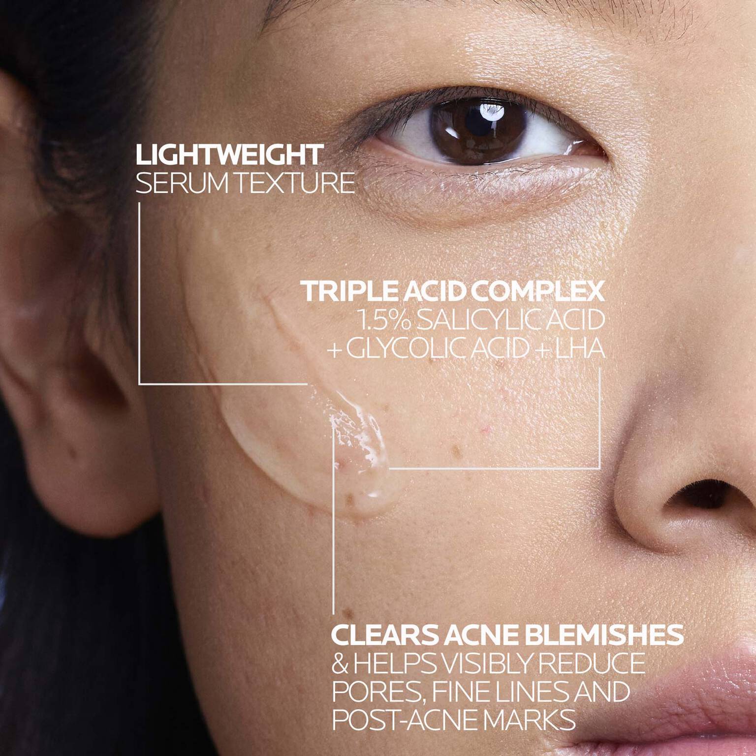 effaclar-salicylic-acid-acne-treatment-serum-y6 LaRochePosay-Product-Effaclar-Effaclar-Serum-30ml-3337875722827-Texture-REV.jpg