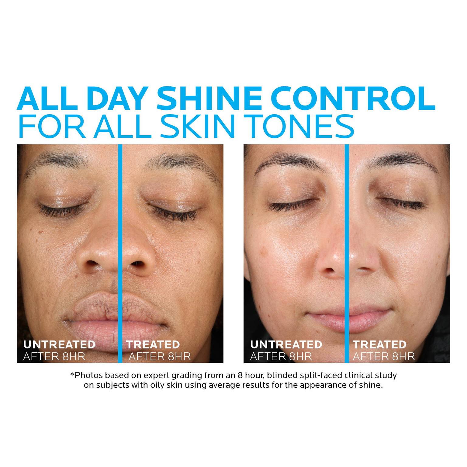 toleriane-double-repair-matte-face-moisturizer-for-oily-skin-r3 la-roche-posay-toleriane-matte-moisturizer-before-and-after-pdp-alt.jpg